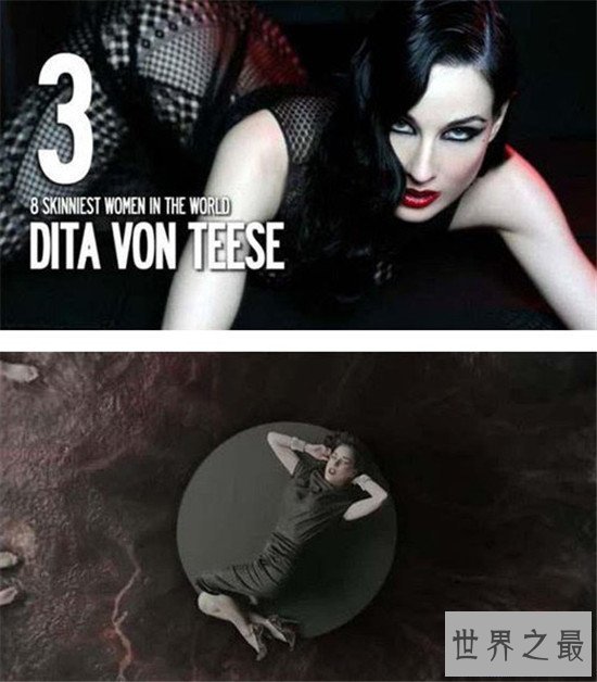 【图】世界上最瘦的人 不要盲目节食减肥损伤身材