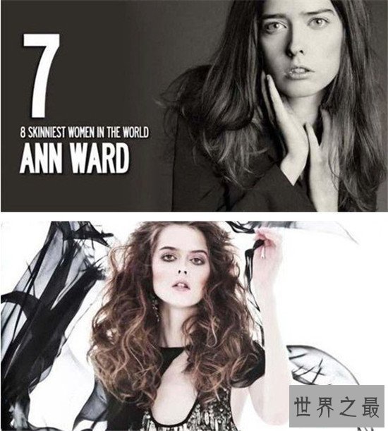 【图】世界上最瘦的人 不要盲目节食减肥损伤身材