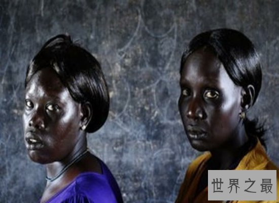 【图】世界上最黑的人丁卡人，以牛为生越黑血缘越好