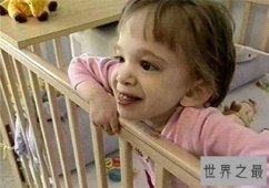 【图】不老女婴存活20年 容貌不变依然6个月婴儿大小