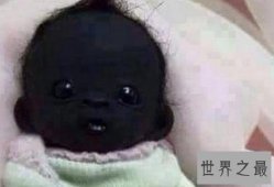 【图】世界上最黑的孩子，全身上下都是黑的，连眼睛