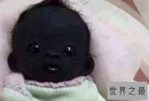 【图】世界上最黑的孩子,全身上下都是黑的,连眼睛