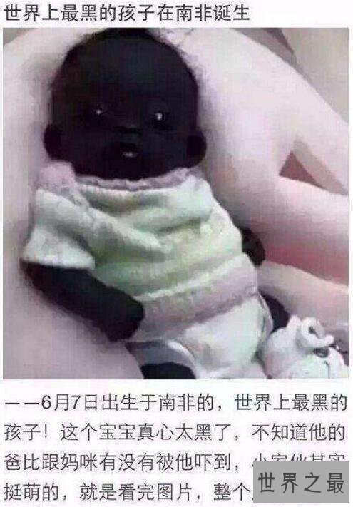 【图】世界上最黑的孩子,全身上下都是黑的,连眼睛
