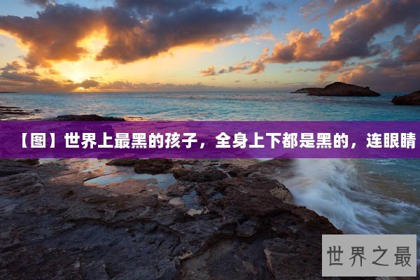 【图】世界上最黑的孩子,全身上下都是黑的,连眼睛 【图】世界上最黑的孩子,全身上下都是黑的,连眼睛