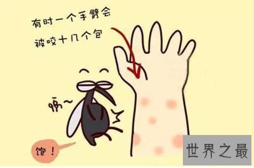 【图】蚊子青睐叮咬什么血型的人 有这五种特点的人要