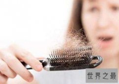 【图】掉头发是什么原因 女生头发稀少应该怎么办