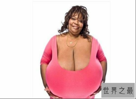 【图】世界上最大的胸 分量20公斤 大到让人们疑心人生