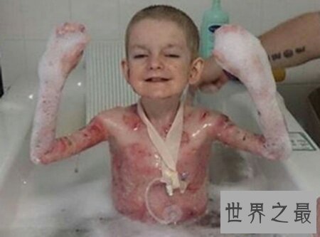 【图】怪病有很多种 感觉这种病是最可怕的