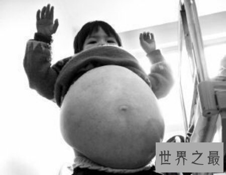 【图】怪病有很多种 感觉这种病是最可怕的