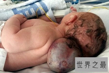 【图】怪病有很多种 感觉这种病是最可怕的