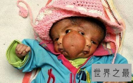 【图】怪病有很多种 感觉这种病是最可怕的