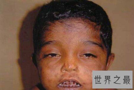 【图】怪病有很多种 感觉这种病是最可怕的