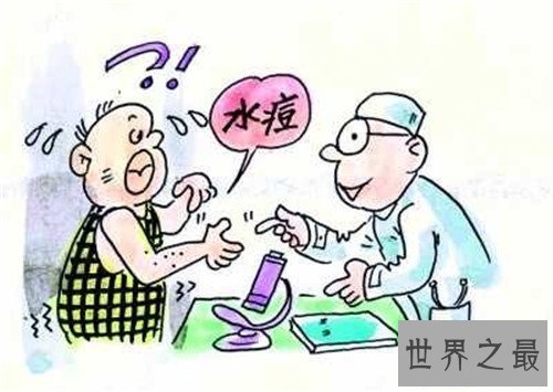 【图】水痘的症状和治疗 长水痘要留意什么事项