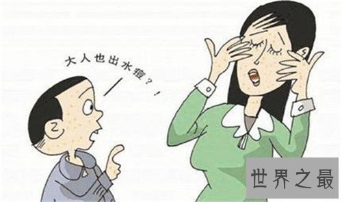 【图】水痘的症状和治疗 长水痘要留意什么事项