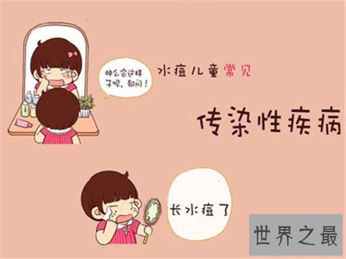 【图】水痘的症状和治疗 长水痘要留意什么事项