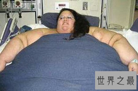 【图】世界上最重的人是谁 她还能像咱们那样失常生存