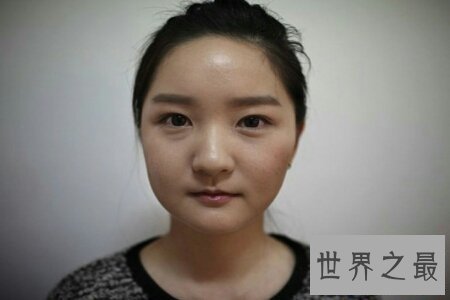 【图】天然美女就是对全身都停止手术然后变美丽的美