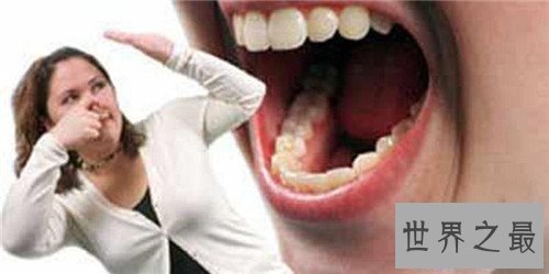 【图】口臭是什么缘由 去除口臭的最好方法有哪些