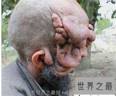 【图】最丑的男人长这样 怎样娶媳妇儿啊