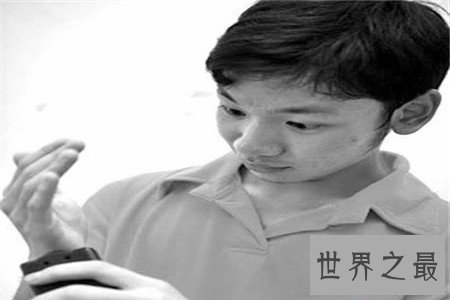 【图】电击男为何可以接受如此高的电压却毫发无伤 真