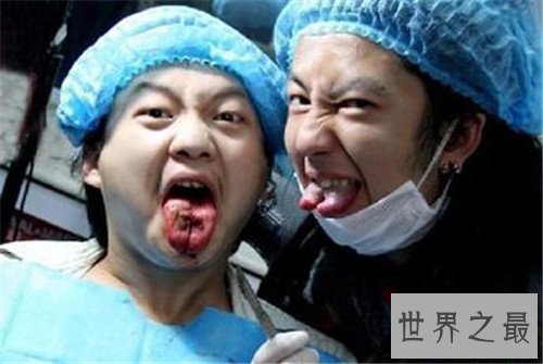 【图】分舌手术的危害及作用 为什么有人会青睐分舌手