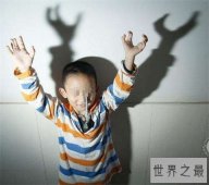 【图】螃蟹手系天生畸形造成 曾有女子听信偏方导致螃