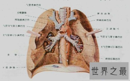 【图】结肠癌晚期症状是谁么样子的呢