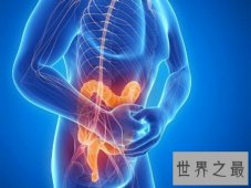 【图】结肠癌晚期症状是谁么样子的呢