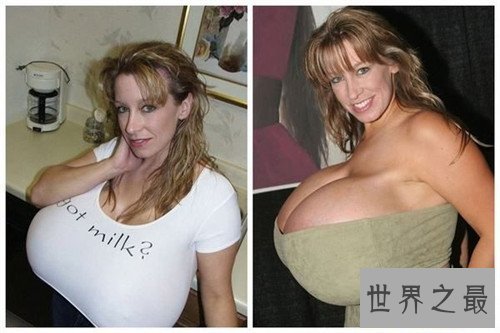 【图】世界上最大的胸长什么样 32Z罩杯假胸容貌惊人