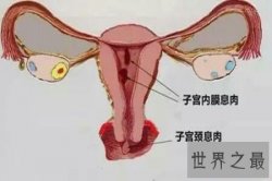 【图】处女膜是什么样子的呢 如果它不在了真的意味着