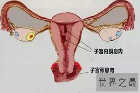 【图】处女膜是什么样子的呢 假设它不在了真的象征着
