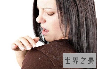 【图】头皮护理竟然这么重要 不要再疏忽了