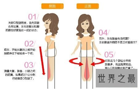 【图】冬季来临为了穿短裤矫正腿型真的很重要