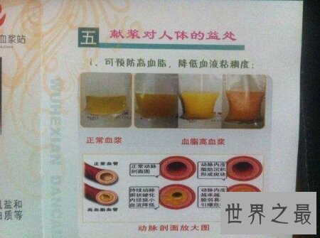 【图】献血无益处是都知道的那么献血浆有没无益处呢