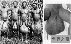 【图】巨阴族生活在非洲原始部落 男性生殖器官达到