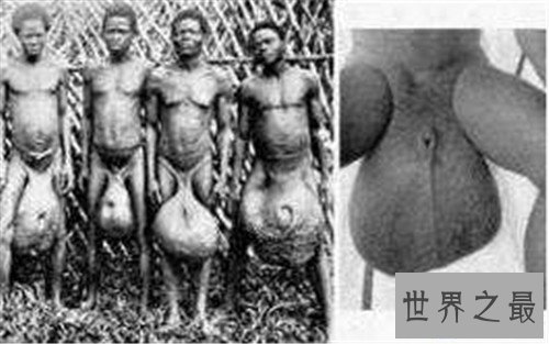 【图】巨阴族生存在非洲原始部落 男性生殖器官达到