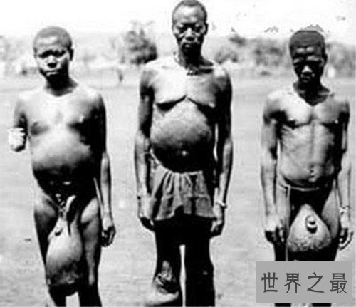 【图】巨阴族生存在非洲原始部落 男性生殖器官达到