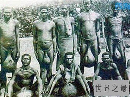 【图】巨阴族生存在非洲原始部落 男性生殖器官达到