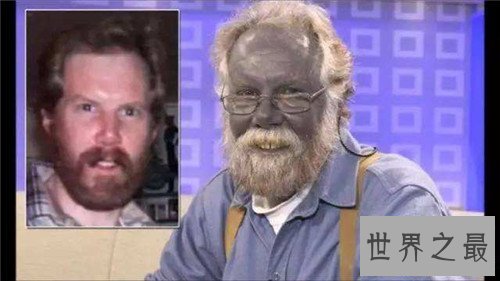 【图】蓝色人种切实存在 皮肤变成蓝色竟然和血液无关