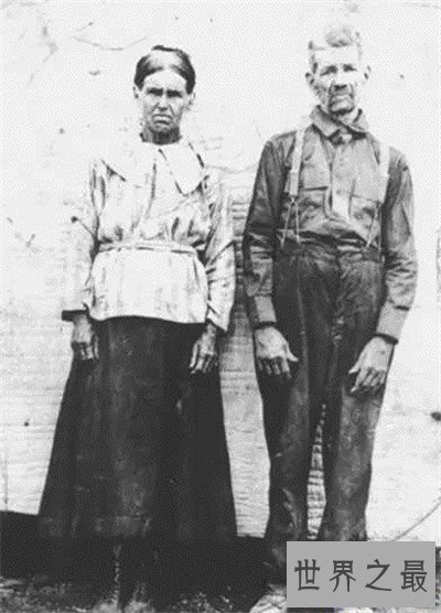 【图】蓝色人种切实存在 皮肤变成蓝色竟然和血液无关