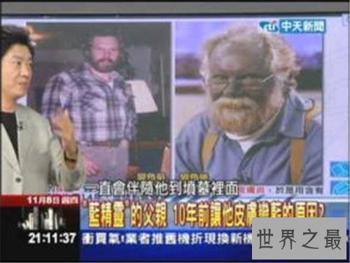 【图】蓝色人种切实存在 皮肤变成蓝色竟然和血液无关
