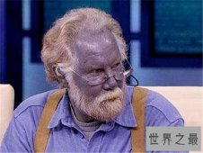 【图】蓝色人种真实存在 皮肤变成蓝色竟然和血液有关