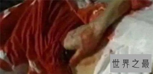 【图】掏肠手事情真凶被判刑 少女掏肠惨案当事人乔建