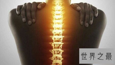 【图】脊椎病的症状是什么样子的 有什么方法可能治好