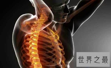 【图】脊椎病的症状是什么样子的 有什么方法可能治好