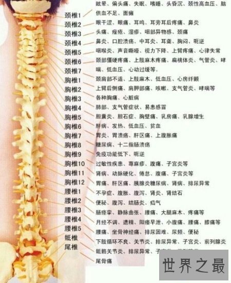 【图】脊椎病的症状是什么样子的 有什么方法可能治好