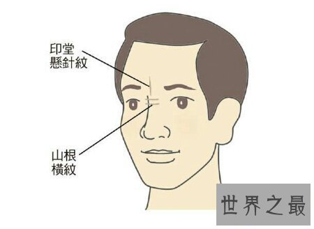 【图】悬针纹真的是由于长工夫不开心所导致的 该怎样