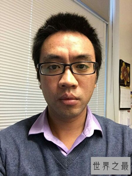 【图】悬针纹真的是由于长工夫不开心所导致的 该怎样