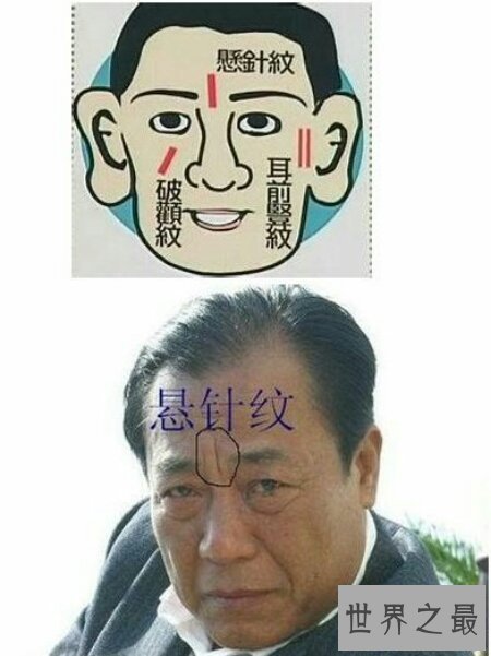 【图】悬针纹真的是由于长工夫不开心所导致的 该怎样