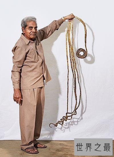 【图】最长的指甲是多长 印度曾有人六十多年没剪过指